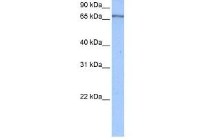 WB Suggested Anti-PABPC4 Antibody Titration:  0. (PABPC4 Antikörper  (Middle Region))