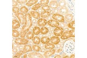 Immunohistochemistry (Paraffin-embedded Sections) (IHC (p)) image for anti-Collagen, Type V (COL5) antibody (ABIN7073547)