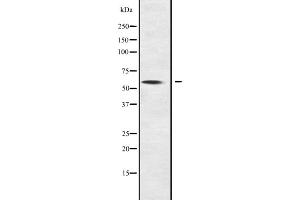 Western blot analysis of NOC4L expression in NOC4L transfected 293T cell lysate;,The lane on the left is treated with the antigen-specific peptide. (NOC4L Antikörper  (Internal Region))