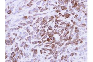 IHC-P Image MX1 Antobody detects MX1 protein at cytosol on MDA-MB-468 xenograft by immunohistochemical analysis. (MX1 Antikörper  (Center))