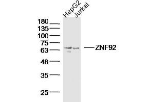 Lane 1: Hepg2 lysates Lane 2: Jurkat lysates probed with ZNF92 Polyclonal Antibody, Unconjugated  at 1:300 dilution and 4˚C overnight incubation.