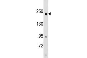 Western blot analysis of RICTOR antibody and SK-BR-3 lysate. (RICTOR Antikörper  (AA 236-267))