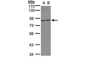 WB Image Sample(30 ug whole cell lysate) A:A431, B:H1299 7. (ZER1 Antikörper  (C-Term))