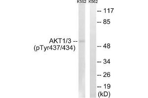 Western blot analysis of extracts from K562 cells, treated with insulin (0. (AKT1/3 (pTyr437) Antikörper)