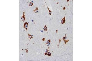 Immunohistochemistry (Paraffin-embedded Sections) (IHC (p)) image for anti-Ribosomal Protein S6 (RPS6) antibody (ABIN6242615)