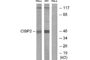 Western blot analysis of extracts from HeLa cells and 293 cells, using CtBP2 antibody.