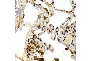 Immunohistochemistry of paraffin-embedded human lung using DP1/DP1/TFDP1 antibody (ABIN6130313, ABIN6149038, ABIN6149040 and ABIN6221075) at dilution of 1:200 (40x lens). (DP1 Antikörper  (AA 1-290))