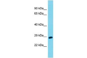 Host: Rabbit Target Name: Uchl3 Sample Type: Mouse Testis lysates Antibody Dilution: 1. (UCHL3 Antikörper  (Middle Region))