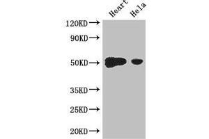 Western Blot Positive WB detected in: Mouse heart tissue, Hela whole cell lysate All lanes: TFDP2 antibody at 3. (DP2 Antikörper  (AA 344-386))
