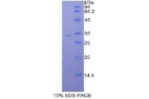 SDS-PAGE (SDS) image for Myosin IB (MYO1B) (AA 779-1040) protein (His tag) (ABIN2121682) (Myosin IB Protein (MYO1B) (AA 779-1040) (His tag))