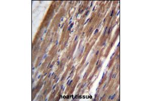 FBLIM1 Antibody (C-term) (ABIN656647 and ABIN2845889) immunohistochemistry analysis in formalin fixed and paraffin embedded human heart tissue followed by peroxidase conjugation of the secondary antibody and DAB staining.