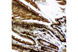 Immunohistochemistry (IHC) image for anti-Tumor Protein P73 (TP73) (AA 1-198) antibody (ABIN3043469)