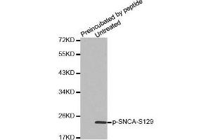 Western Blotting (WB) image for anti-Synuclein, alpha (SNCA) (pSer129) antibody (ABIN1682058) (SNCA Antikörper  (pSer129))