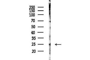 anti-Partner of Y14 and mago (WIBG) antibody