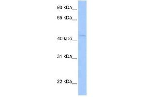 LIPT1 antibody used at 1 ug/ml to detect target protein.