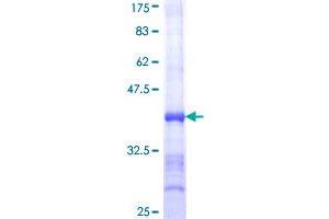 ATP2A1/SERCA1 Protein (AA 522-612) (GST tag)