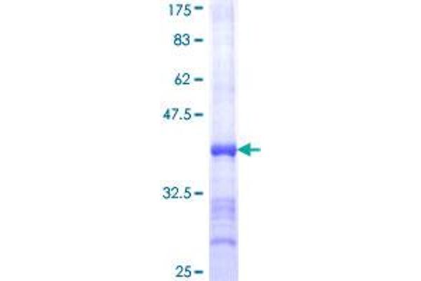 ATP2A1/SERCA1 Protein (AA 522-612) (GST tag)