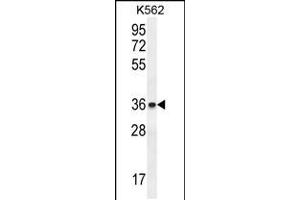 Western blot analysis in K562 cell line lysates (35ug/lane). (ETV2 Antikörper  (N-Term))