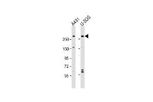 All lanes : Anti-NBAS Antibody (N-Term) at 1:2000 dilution Lane 1: A431 whole cell lysate Lane 2: U-2OS whole cell lysate Lysates/proteins at 20 μg per lane.