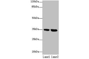 Western blot All lanes: TMEM165 antibody at 8 μg/mL Lane 1: Jurkat whole cell lysate Lane 2: Hela whole cell lysate Secondary Goat polyclonal to rabbit IgG at 1/10000 dilution Predicted band size: 35, 29 kDa Observed band size: 35 kDa (TMEM165 Antikörper  (AA 173-228))