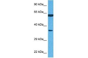 Host:  Rabbit  Target Name:  P4HB  Sample Tissue:  Human MCF7 Whole Cell  Antibody Dilution:  1ug/ml (P4HB Antikörper  (N-Term))