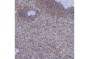 IHC analysis of TRMT61A using anti-TRMT61A antibody (ABIN7599220).