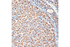Immunohistochemistry of paraffin-embedded rat ovary using Slit2 Rabbit mAb (ABIN7270335) at dilution of 1:100 (40x lens). (SLIT2 Antikörper)