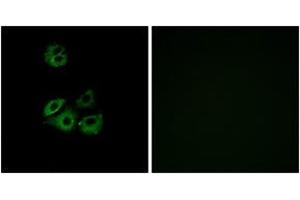 Immunofluorescence analysis of A549 cells, using CCBP2 Antibody. (CCBP2 Antikörper  (AA 335-384))