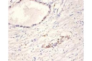 Immunohistochemistry of paraffin-embedded human prostate tissue using ABIN7161468 at dilution of 1:100