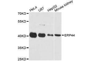 Western blot analysis of extracts of various cell lines, using ERP44 antibody (ABIN5972576) at 1:3000 dilution. (ERP44 Antikörper)