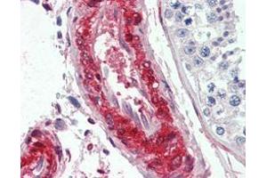 Immunohistochemistry (IHC) image for anti-Lipoma-preferred partner (LPP) antibody (ABIN969263)