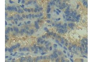 Immunohistochemistry (IHC) image for anti-Complement C2 (AA 245-451) antibody (ABIN7432784)