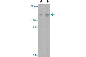 Western blot analysis of Rptor in L1210 cell lysate with Rptor polyclonal antibody  at (A) 2 and (B) 4 ug/mL . (Raptor Antikörper  (C-Term))