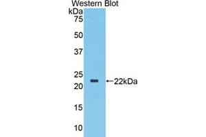 Western blot analysis of the recombinant protein. (TLR3 Antikörper  (AA 533-705))