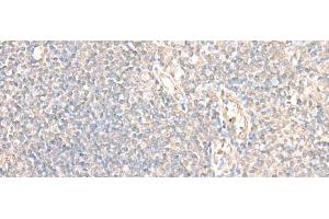 Immunohistochemistry of paraffin-embedded Human tonsil tissue using PARS2 Polyclonal Antibody at dilution of 1:30(x200) (PARS2 Antikörper)