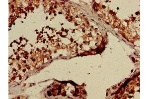 Immunohistochemistry of paraffin-embedded human testis tissue using ABIN7147850 at dilution of 1:100 (CLTCL1 Antikörper  (AA 1423-1566))