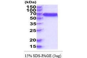 SDS-PAGE (SDS) image for Interleukin 10 Receptor, beta (IL10RB) (AA 20-220) protein (hIgG-His-tag) (ABIN5854992)
