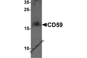 Western Blotting (WB) image for anti-CD59 (CD59) (N-Term) antibody (ABIN1077443) (CD59 Antikörper  (N-Term))