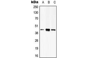 Western blot analysis of PSKH2 expression in Hela (A), HEK293T (B), mouse brain (C) whole cell lysates. (PSKH2 Antikörper  (Center))