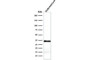 Western Blot Analysis of Endometrium lysate using Calponin-1 Recombinant Mouse Monoclonal Antibody (rCNN1/832). (Rekombinanter CNN1 Antikörper)