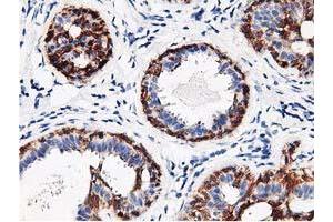 Immunohistochemical staining of paraffin-embedded Human breast tissue using anti-RBBP7 mouse monoclonal antibody. (RBBP7 Antikörper)