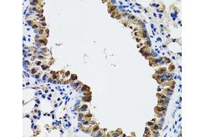 Immunohistochemistry of paraffin-embedded Mouse lung using ESD Polyclonal Antibody at dilution of 1:100 (40x lens). (Esterase D Antikörper)