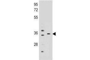 KCNRG Antikörper  (AA 175-202)