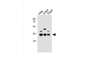 All lanes : Anti-BCKDHB Antibody (N-term) at 1:1000 dilution Lane 1: Hela whole cell lysate Lane 2: Jurkat whole cell lysate Lane 3: Daudi whole cell lysate Lysates/proteins at 20 μg per lane.