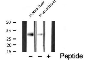 Western blot analysis of extracts of various tissue sample,using CTDSP1 Antibody . (CTDSP1 Antikörper  (N-Term))