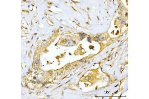 IHC analysis of EIF3E using anti-EIF3E antibody (ABIN7600190).