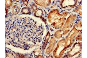 Immunohistochemistry of paraffin-embedded human kidney tissue using ABIN7175662 at dilution of 1:100 (SORCS2 Antikörper  (AA 712-786))