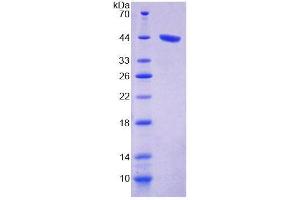 SDS-PAGE analysis of Human PKCd Protein. (PKC delta Protein)