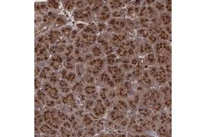 Immunohistochemical staining of human pancreas with TRIP11 polyclonal antibody  shows strong cytoplasmic positivity with a granular pattern in exocrine glandular cells.