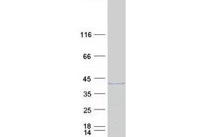 GEM Protein (Transcript Variant 2) (Myc-DYKDDDDK Tag)